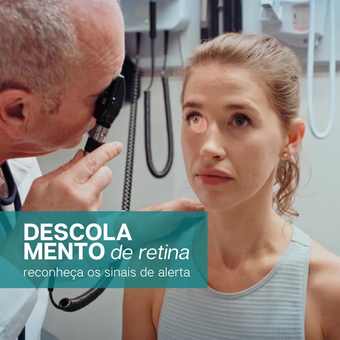 Descolamento de Retina: Reconheça os Sinais de Alerta Precoce